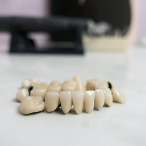 Zirconium all-ceramic crown