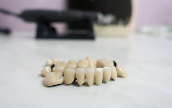 Zirconium all-ceramic crown